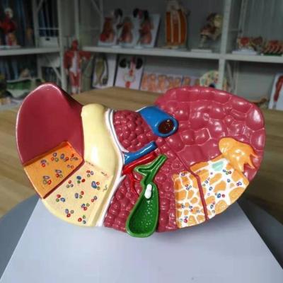 China Liver Cancer Human Pathological Anatomy Model Medical Faculty Liver Bilological Liver For School Medical Teaching Display Tool Lab Equipment for sale