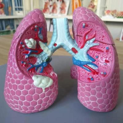 China Advanced Medical Anatomical Teaching Supplies Human Lung Pathological Model For Anatomical Teaching for sale