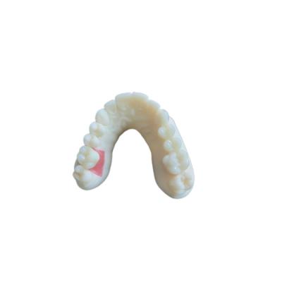 Κίνα Ψηφιακή στοματική σάρωση PFM Dental Crowns Bridge Εμφυτευματολογία Απαιτήσεις προς πώληση