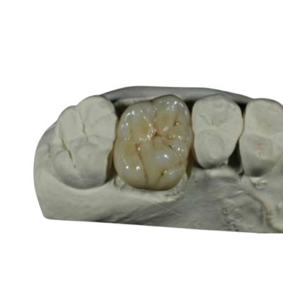 China Coroa dental da porcelana flexível do ISO do CE para a restauração dos dentes traseiros à venda