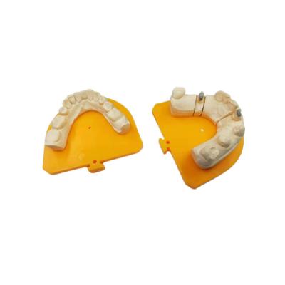 China Coroa cerâmica dental da coroa PFM da porcelana de grande resistência do ouro amarelo à venda