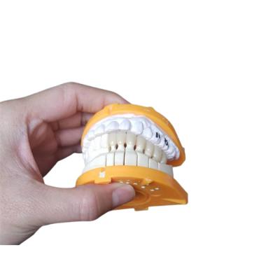 China Coroas cerâmicas feitas sob encomenda do tamanho PFM para os dentes traseiros e anteriores à venda