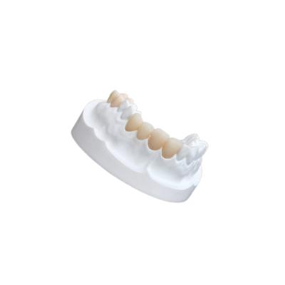 China IPS E Max Ceramic Dental Crown Comfortable Porcelain Composite Veneers for sale