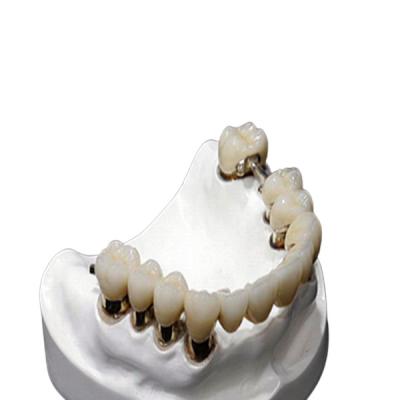 China CO CR MK1 Precision Attachment Denture Corrosion Resistance for sale