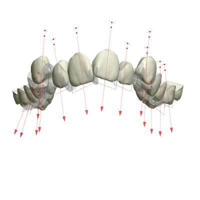 China Bom Biocompatibility fixou o retentor de borracha dos dispositivos ortodônticos à venda