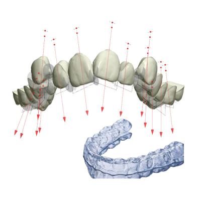 China Halter stützt FDA reparierte orthodontisches Gerät mit 3D ab zu verkaufen