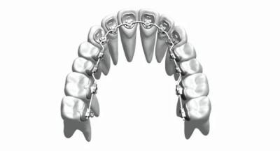 China Custom Fixed Orthodontic Appliances Braces Straighten Teeth Stainless Steel Bioceramic for sale