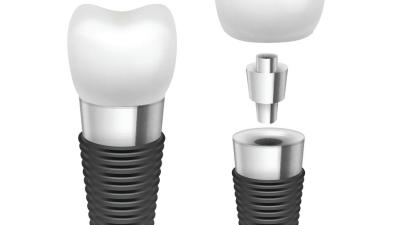 China Implante dental Rod Comfortable Highly Biocompatible Implant do cromo do titânio/cobalto à venda