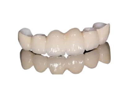 China Aparência natural da coroa dental resistente à corrosão da porcelana para Front Teeth/dentes traseiros à venda