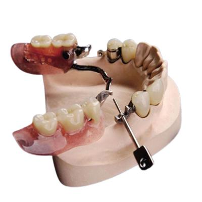 China Mk1 Precision Attachment Denture Beautiful Natural Corrosion Resistant for sale