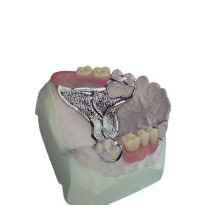 China Custom OEM Cast Removable Partial Denture High Strength Digitization Design for sale