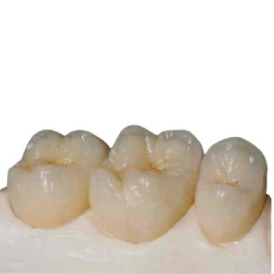 China Computer-aided Manufactured Customized Zirconia Dental Crown for sale