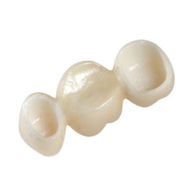 China Beautiful Natural All Ceramic Crown Zirconia Material Good Biocompatibility for sale