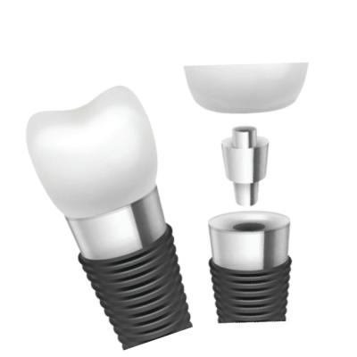 Κίνα Dental Implant Bars Material Innovation For Superior Performance προς πώληση