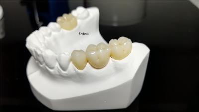 Cina Corone dentali in ceramica, corone dentali in zirconia in vendita