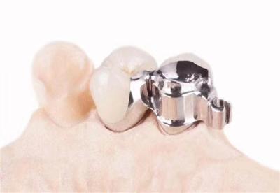 Κίνα Customized precision accessories for dental clinics προς πώληση