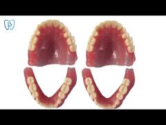 Digital Design 3D Printed Flexible Acrylic Denture Dental Lab