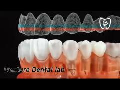 Zirconia Denture Dental lab Teeth High Hardness CAD / CAM Technology