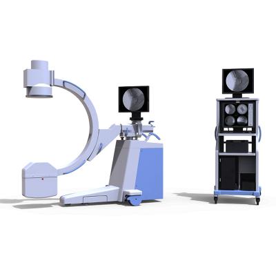 China PLX112C Hospital C-arm Portable High Frequency X Ray Machine Price 35KJ (47HU) System for sale