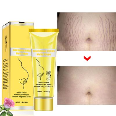 China Rose Brightening Anti Wrinkle Remove Stretch Marks Cream Maternity Repair Anti Aging Skin Remove Pregnancy Marks Treatment Body Skin Care for sale