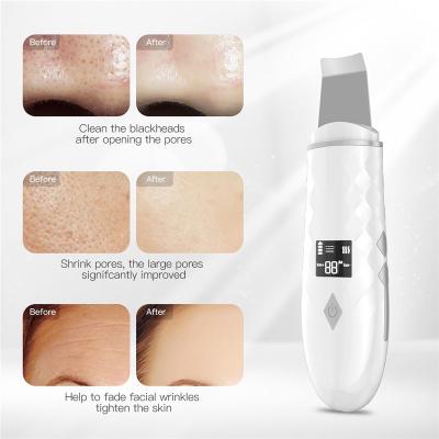 China OEM Direct Sales True Face Lift Ultrasonic Face Beauty Skin Dead Scrubber Skin Scrubber Exfoliating Device for sale