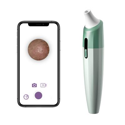 China Effectively Remove Blackheads Suction USB Replaceable Blackhead Remover With HD Camera for sale