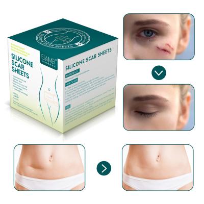 China Hot Selling ELAIMEI Silicone Scar Gel Roll Acne Skin Care Scar Removal Scar And Stretch Marks Medical Silicone Scar Sheet Removal Treatment for sale