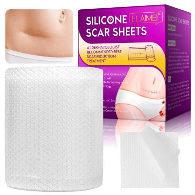 China Elaimei Health Care Scar Roll 1.5 Meters OEM ODM Private Label Skin Care Scar Remover Correction Silicone Scar Roll Medical 1.5 Meter Patches for sale