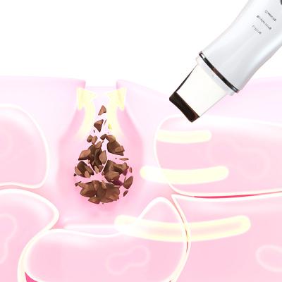 China DEEP CLEANSING Ultrasonic Skin Scrubber Shovel Knife Use for Cleans and Shrinks Pores, Cleans Skin, and Leaves Skin Smooth and Elastic for sale