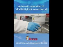 V Bottom Viral DNA RNA Kit For Viral Nucleic Acid Extraction Prefilled Plates 96 Reactions