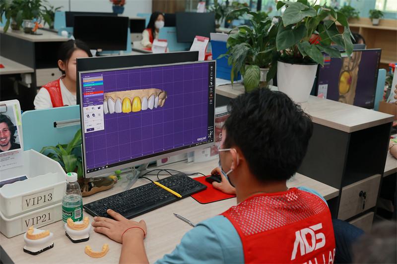 Proveedor verificado de China - ADS Dental Lab