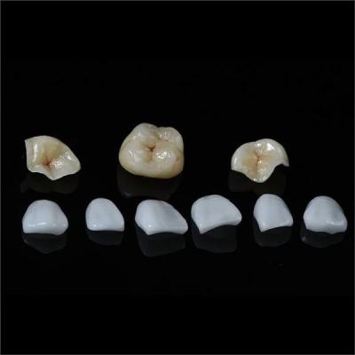 China Tooth All Porcelain IPS Emax Inlay Onlay Veneer Aesthetic In Dentistry for sale