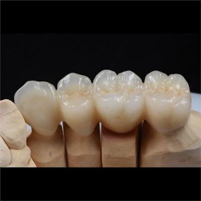 China Biocompatible Zirconia Ceramic Dental Crown Tooth Restorations Custom for sale