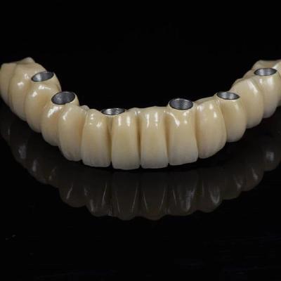 China All On 6 PFM Titanium Bridge Dental Crown Full Arch Implant for sale