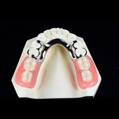 China Premium Full Metal Frame Denture Co Cr Framework Cobalt Chromium Alloy for sale