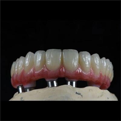 China ODM Full Arch Zirconia Implants Bridge Zirconium Implants Holistic Dentistry for sale