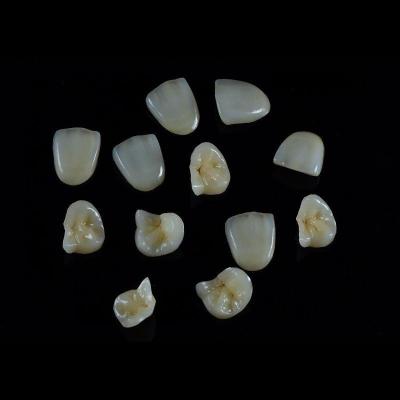 China Restaurações dentárias IPS EMax Inlay Onlay All Porcelain Altamente durável à venda