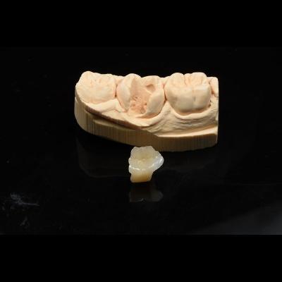 China Metal Free Composite Crowns Inlays And Onlays Bridges Implants ODM for sale