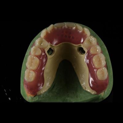 China Peek Thermoplastic Partial Dentures  PEEK Framework for sale