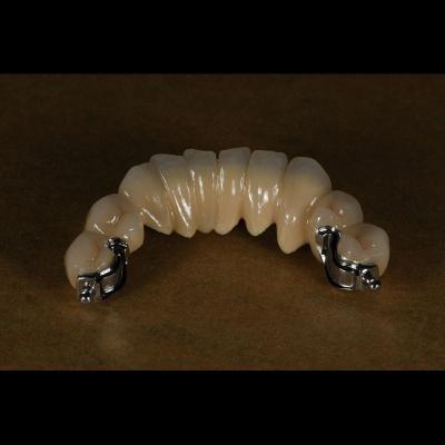 China Aesthetic Partial Denture Precision Attachments Medical Grade OEM for sale