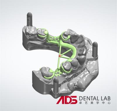 China Cuadro metálico fundido oculto Cuadro de dentadura parcial Arco completo parcial en venta