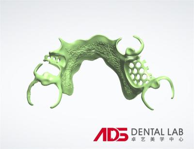 China ADS Dental Lab Partial Metal Frame Denture Framework Fabrication for sale