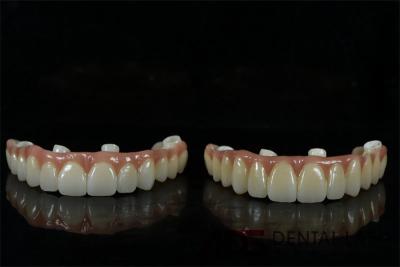 China OEM White Tooth Implant And Bridge Dentistry Natural looking for sale