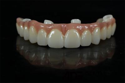 China Precieze tandheelkundige implantaten Kronen en bruggen Custom Abutment Te koop