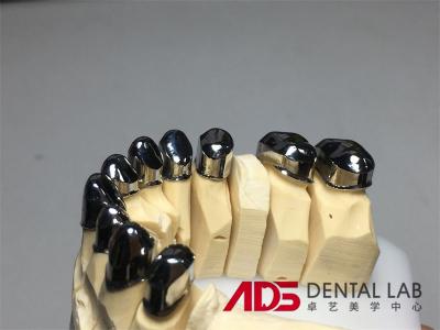 Cina Telescopio per denti parziali di precisione in metallo personalizzato in vendita