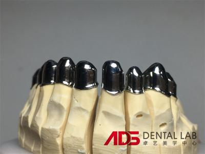 China China Laboratorio Dental Implantes dentales adjustables telescópicos en venta