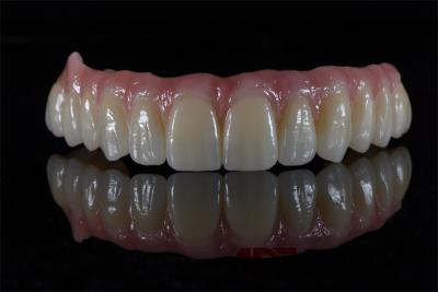 China China Dental Lab All On 4 Bridge Full Arch Implant Bridge In Demistry for sale