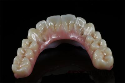 China All On 6 Zirconia Dental Implant Supported Bridge Full Arch Custom for sale