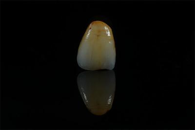 Cina Precise porcellana bianca stratificata con macchia di zirconia Emax OEM in vendita