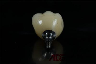 China China Dental Lab Ceramic Zirconia Screw Retained Dental Implant Single Tooth Replacement for sale